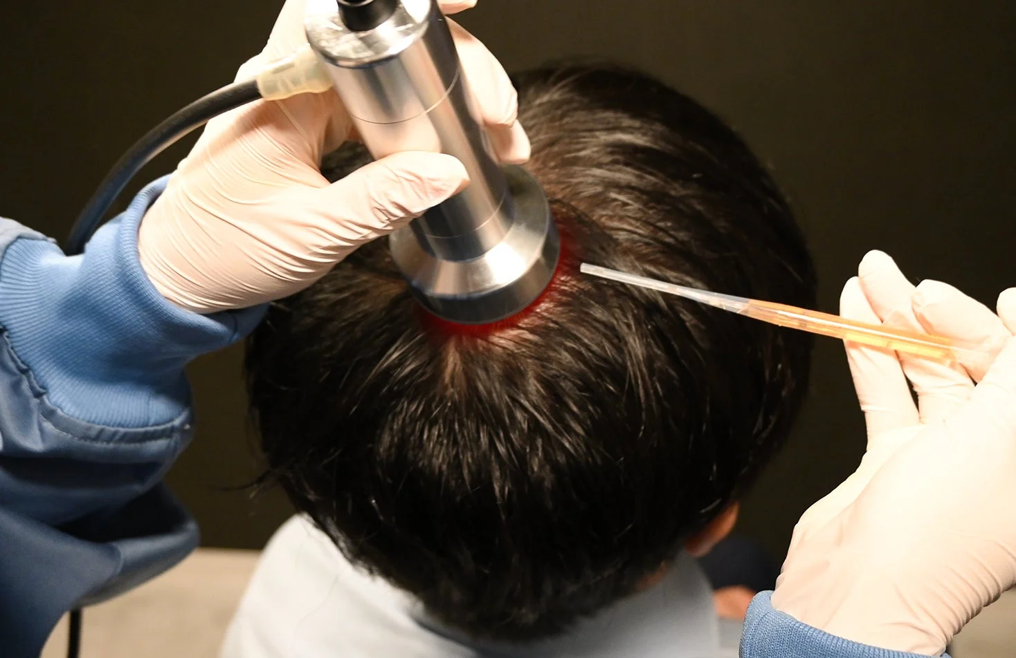 頭皮ケアの施術イメージ