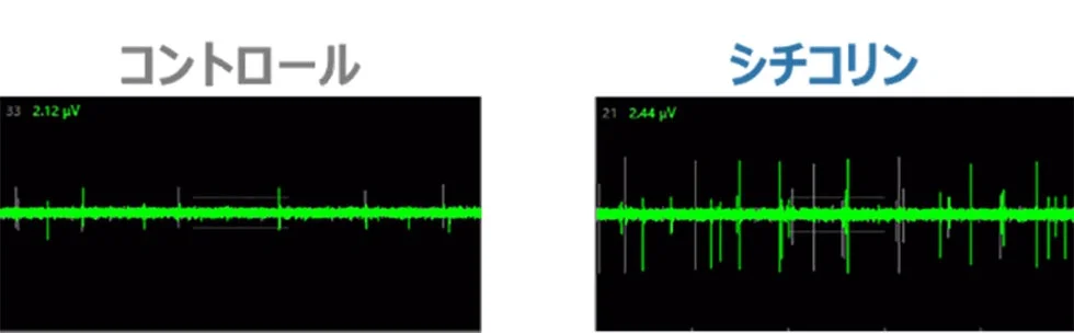 腸を介した神経活性化の実試験結果