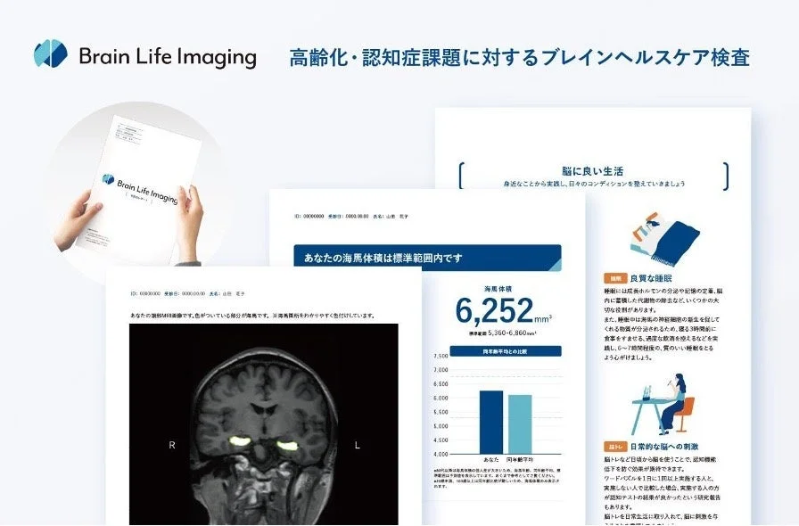 脳ドック用AIプログラム「Brain Life Imaging」