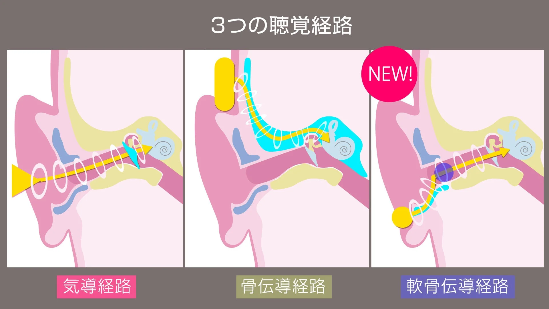 聴覚経路、耳の構造、気導、骨伝導、軟骨伝導、解剖学、医学、図解、音の伝わり方、新技術